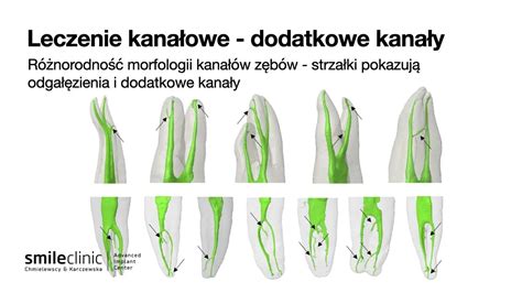 Schemat podwójnego oczka geopatycznego z zaznaczonymi kanałami