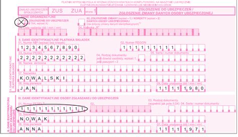 Przykładowy druk ZUS ZUA.