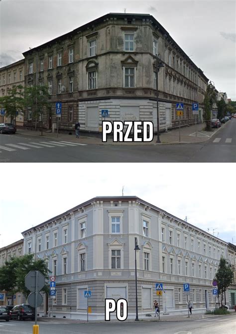 Tabela porównująca refundację gorsetów i ortez przed i po zmianach