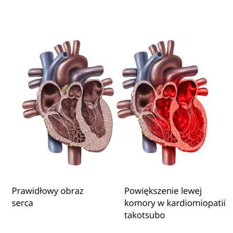 Symboliczne przedstawienie złamanego serca